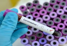 Amazonas apresenta aumento de síndrome respiratória por Covid-19, aponta Fiocruz Covid