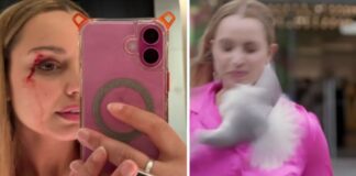 Repórter é atingida por gaivota durante gravação