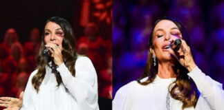 Ivete Sangalo faz primeiro show após acidente e fala sobre ida ao hospital