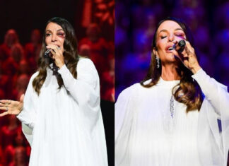 Ivete Sangalo faz primeiro show após acidente e fala sobre ida ao hospital