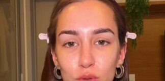 Influencer brasileira paga mais de R$ 80 mil após mordida de poodle nos EUA