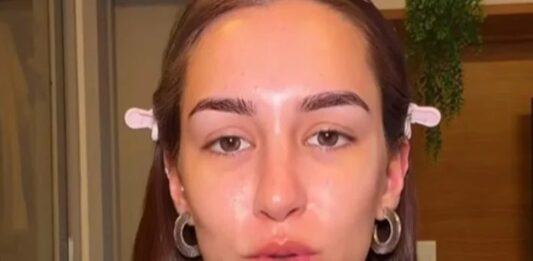 Influencer brasileira paga mais de R$ 80 mil após mordida de poodle nos EUA